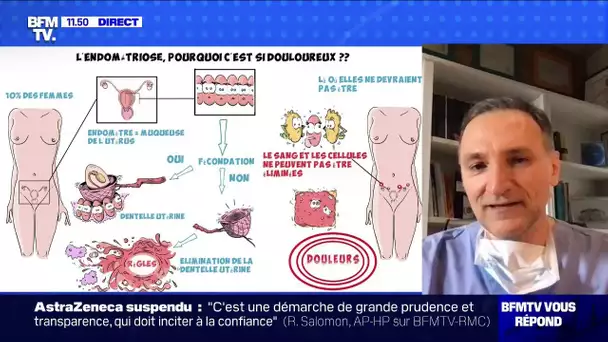 L'endométriose bientôt reconnue comme affection longue durée ? BFMTV répond à vos questions