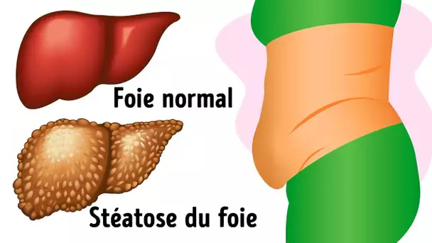 10 Signes Avant-Coureurs Que Ton Foie Est Plein de Toxines