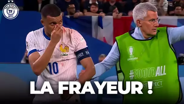 L'ENORME COUP pris par Mbappé face à l'Autriche (nez cassé ?!) 😱 - La Quotidienne #1554