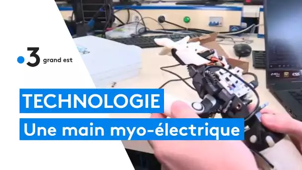 Technologie : une main myo-électrique conçue à l'IUT de Mulhouse