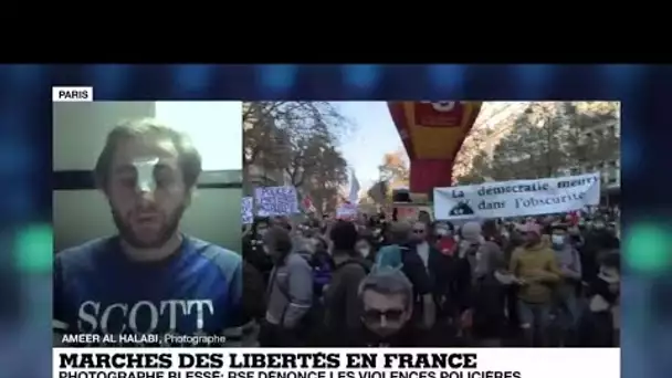 Le photographe Ameer al Halabi, blessé lors de la Marche des Libertés, toujours "sous le choc"