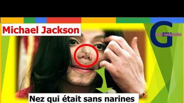 Michael Jackson adepte de la chirurgie esthétique : la vérité sur son nez enfin dévoilée