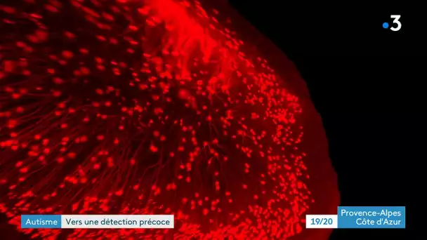Autisme, vers une détection précoce grâce à l'intelligence artificielle