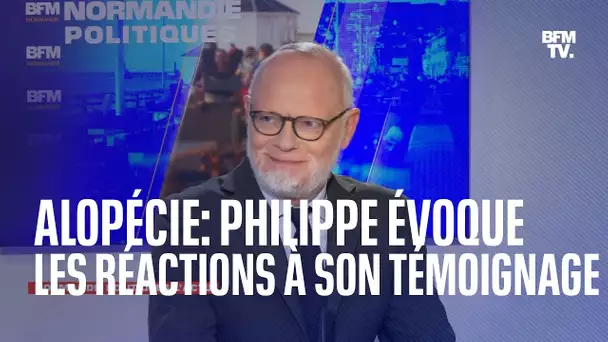 Alopécie: Édouard Philippe a reçu "beaucoup de sympathie" après son témoignage