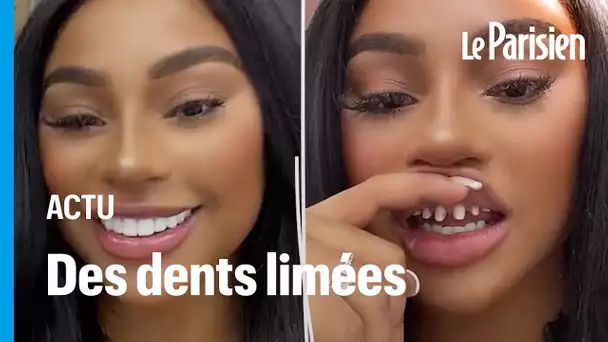 «Il aura un dentier à 30 ans» : la tendance des dents limées qui inquiète les dentistes