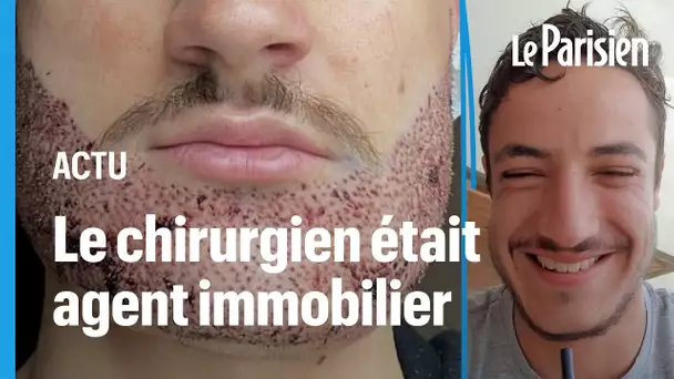 Jacques a perdu son fils après une greffe de barbe ratée en Turquie