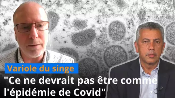 "La variole du singe ne devrait pas être comme l'épidémie de Covid"