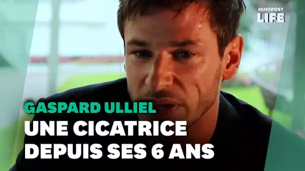 Gaspard Ulliel et sa cicatrice, l'histoire derrière cette marque qui faisait "partie de lui"