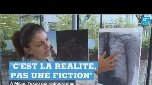 Violences conjugales : l'exposition choc d'un hôpital de Milan