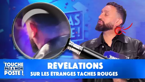 TPMP rewind : révélations sur les étranges taches rouges de Cyril Hanouna...