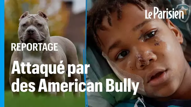 « J’ai cru que j’allais mourir » : Haïlé, 10 ans, mordu au visage par des chiens American Bully