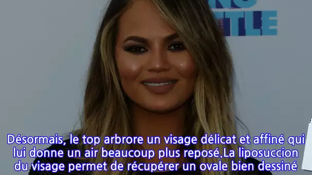 Chrissy Teigen : Très fière du résultat de sa dernière opération de chirurgie...