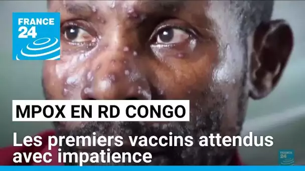 Epidémie de Mpox en RD Congo : les premiers vaccins attendus avec impatience • FRANCE 24