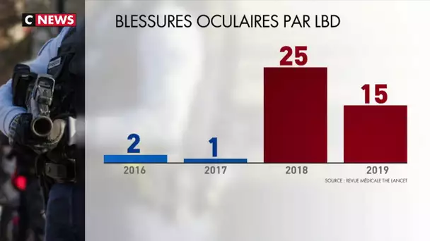 LBD : hausse du nombre de blessures aux yeux