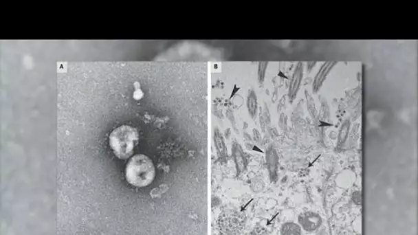 Coronavirus : une course contre la montre scientifique