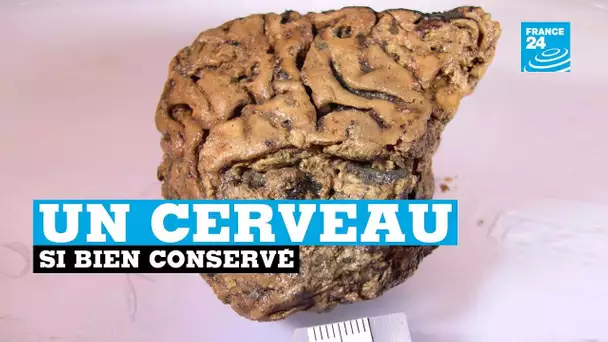 Pourquoi ce cerveau humain vieux de 2 600 ans est-il si bien conservé ?