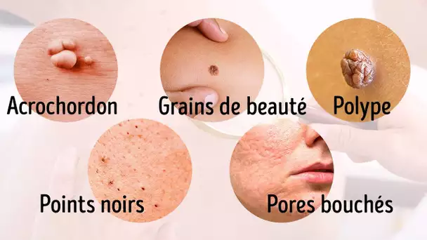 8 Maladies Graves Que Notre Peau Nous Signale