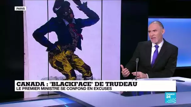 "Le blackface choque partout, pas qu'en Amérique du Nord"