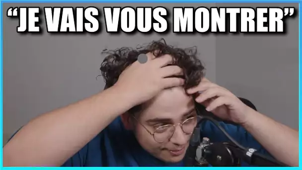 Kameto fait un calvitie check et montre sa hairline