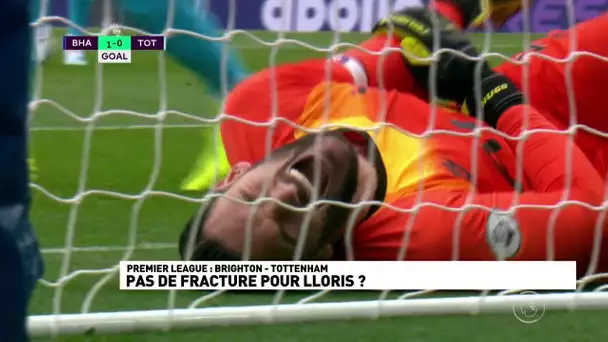 Pas de fracture pour Lloris ?